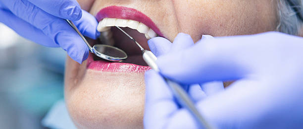 Best Urgent Care for Lost Fillings or Crowns in Berlin, MD